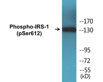 Phospho-IRS-1 (Ser612) Colorimetric Cell-Based ELISA Kit