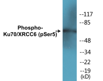 Phospho-Ku70/XRCC6 (Ser5) Colorimetric Cell-Based ELISA Kit