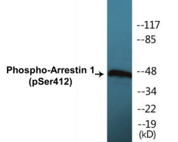 Phospho-Arrestin 1 (Ser412) Colorimetric Cell-Based ELISA Kit