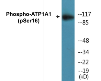 Phospho-ATP1A1 (Ser16) Colorimetric Cell-Based ELISA Kit