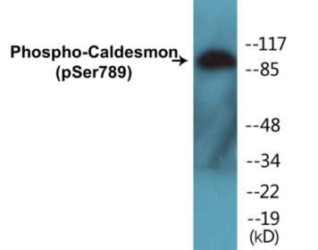 Phospho-Caldesmon (Ser789) Colorimetric Cell-Based ELISA Kit