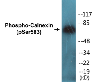 Phospho-Calnexin (Ser583) Colorimetric Cell-Based ELISA Kit