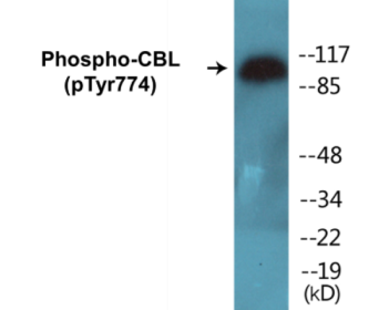 Phospho-CBL (Tyr774) Colorimetric Cell-Based ELISA Kit