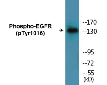 Phospho-EGFR (Tyr1016) Colorimetric Cell-Based ELISA Kit