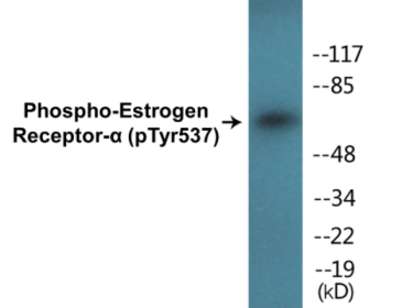 Phospho-Estrogen Receptor-alpha (Tyr537) Colorimetric Cell-Based ELISA Kit