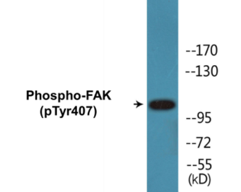 Phospho-FAK (Tyr407) Colorimetric Cell-Based ELISA Kit