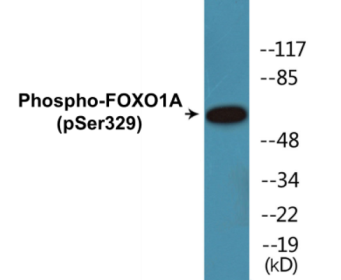 Phospho-FOXO1A (Ser329) Colorimetric Cell-Based ELISA Kit