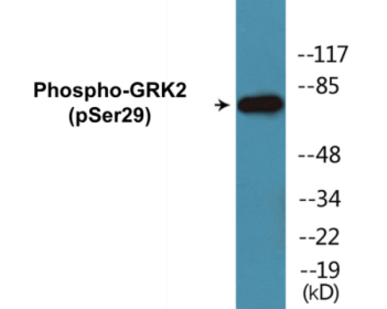 Phospho-GRK2 (Ser29) Colorimetric Cell-Based ELISA Kit