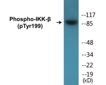 Phospho-IKK-beta (Tyr199) Colorimetric Cell-Based ELISA Kit