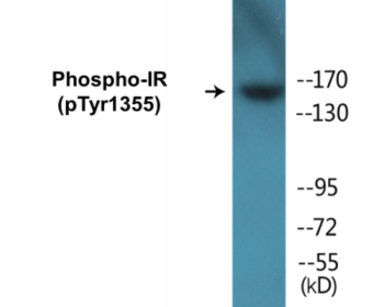 Phospho-IR (Tyr1355) Colorimetric Cell-Based ELISA Kit