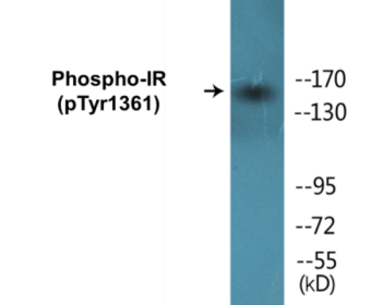 Phospho-IR (Tyr1361) Colorimetric Cell-Based ELISA Kit