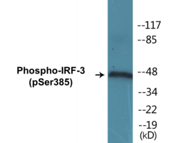 Phospho-IRF-3 (Ser385) Colorimetric Cell-Based ELISA Kit