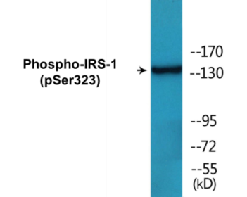 Phospho-IRS-1 (Ser323) Colorimetric Cell-Based ELISA Kit