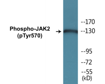 Phospho-JAK2 (Tyr570) Colorimetric Cell-Based ELISA Kit