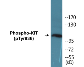 Phospho-KIT (Tyr936) Colorimetric Cell-Based ELISA Kit