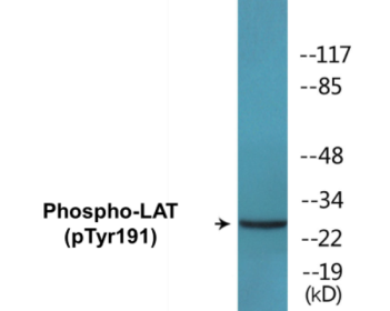 Phospho-LAT (Tyr191) Colorimetric Cell-Based ELISA Kit