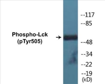 Phospho-Lck (Tyr505) Colorimetric Cell-Based ELISA Kit
