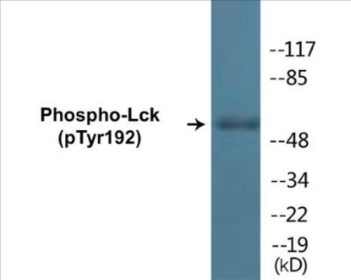 Phospho-Lck (Tyr192) Colorimetric Cell-Based ELISA Kit