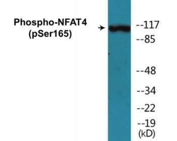 Phospho-MYPT1 (Thr853) Colorimetric Cell-Based ELISA Kit