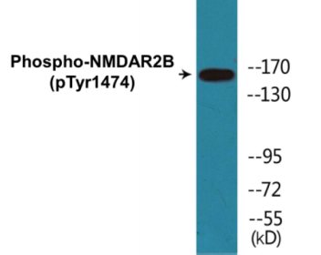Phospho-NFAT3 (Ser676) Colorimetric Cell-Based ELISA Kit