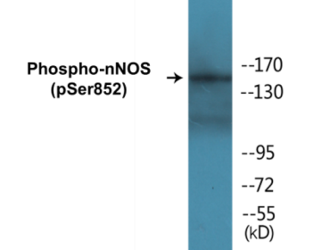 Phospho-NFAT4 (Ser165) Colorimetric Cell-Based ELISA Kit