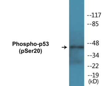 Phospho-NMDAR2B (Tyr1474) Colorimetric Cell-Based ELISA Kit