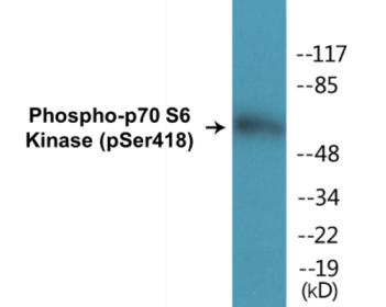 Phospho-p70 S6 Kinase (Ser418) Colorimetric Cell-Based ELISA Kit