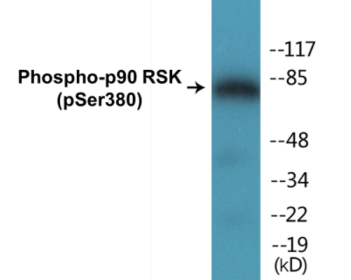 Phospho-p90 RSK (Ser380) Colorimetric Cell-Based ELISA Kit