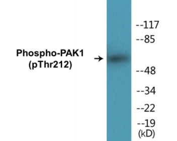 Phospho-PAK1 (Thr212) Colorimetric Cell-Based ELISA Kit