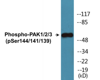 Phospho-PAK1/2/3 (Ser144/141/139) Colorimetric Cell-Based ELISA Kit