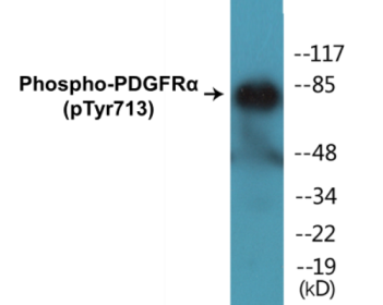 Phospho-PDGFRalpha (Tyr713) Colorimetric Cell-Based ELISA Kit