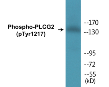 Phospho-PLCG2 (Tyr1217) Colorimetric Cell-Based ELISA Kit