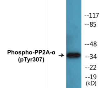 Phospho-PP2A-alpha (Tyr307) Colorimetric Cell-Based ELISA Kit
