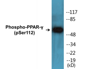 Phospho-PPAR-gamma (Ser112) Colorimetric Cell-Based ELISA Kit