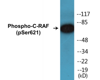 Phospho-C-RAF (Ser621) Colorimetric Cell-Based ELISA Kit