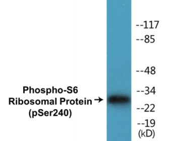 Phospho-S6 Ribosomal Protein (Ser240) Colorimetric Cell-Based ELISA Kit