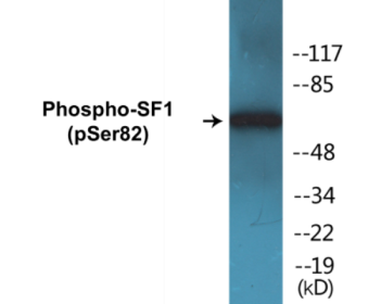 Phospho-SF1 (Ser82) Colorimetric Cell-Based ELISA Kit
