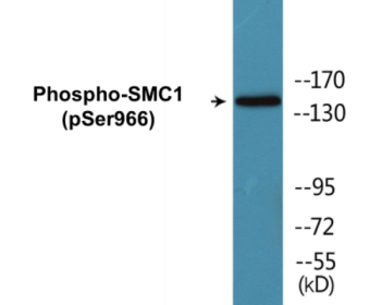 Phospho-SMC1 (Ser966) Colorimetric Cell-Based ELISA Kit