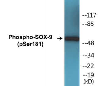 Phospho-SOX-9 (Ser181) Colorimetric Cell-Based ELISA Kit