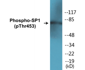 Phospho-SP1 (Thr453) Colorimetric Cell-Based ELISA Kit