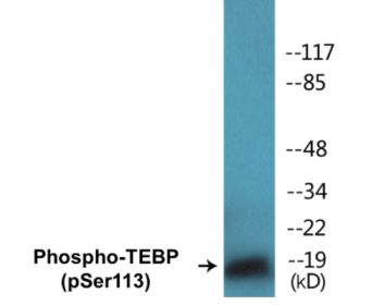 Phospho-TEBP (Ser113) Colorimetric Cell-Based ELISA Kit