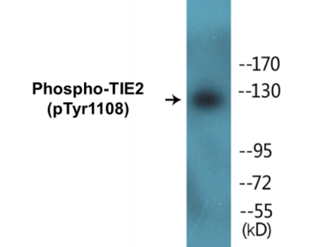 Phospho-TIE2 (Tyr1108) Colorimetric Cell-Based ELISA Kit