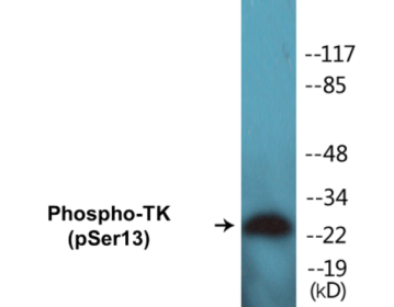 Phospho-TK (Ser13) Colorimetric Cell-Based ELISA Kit