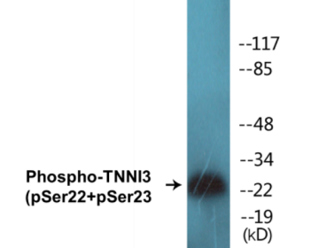 Phospho-TNNI3 (Ser22+Ser23) Colorimetric Cell-Based ELISA Kit