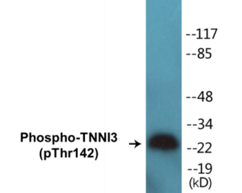 Phospho-TNNI3 (Thr142) Colorimetric Cell-Based ELISA Kit