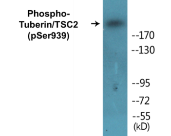 Phospho-Tuberin/TSC2 (Ser939) Colorimetric Cell-Based ELISA Kit