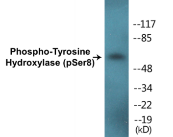 Phospho-Tyrosine Hydroxylase (Ser8) Colorimetric Cell-Based ELISA Kit