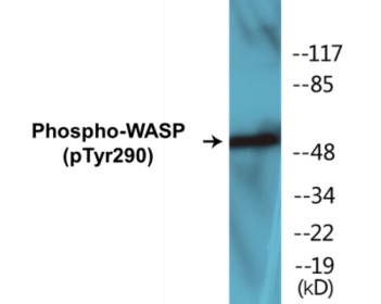 Phospho-WASP (Tyr290) Colorimetric Cell-Based ELISA Kit