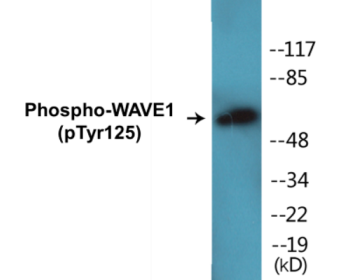 Phospho-WAVE1 (Tyr125) Colorimetric Cell-Based ELISA Kit
