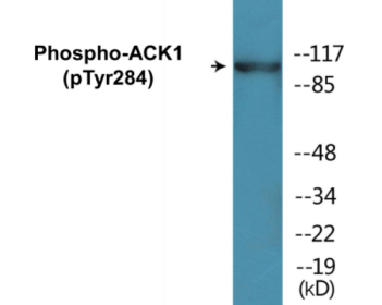 Phospho-ACK1 (Tyr284) Colorimetric Cell-Based ELISA Kit